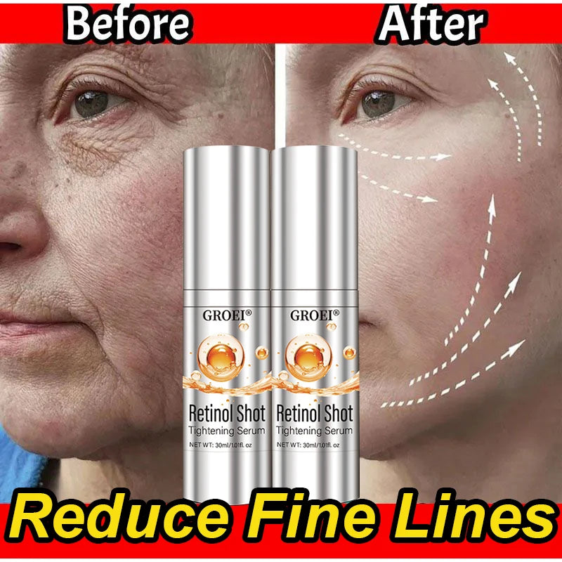 Vita A Retinol Shot Facial Tightening Serum,Eye Tightening Moisturizing Booster Cream,Reduce Wrinkles & Fine Lines,Anti-Aging