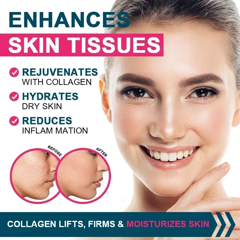 Multiple Collagen - Skin, Joints, Hair, Nail Health, Antioxidant - Collagen Types I, II, III, V, and X