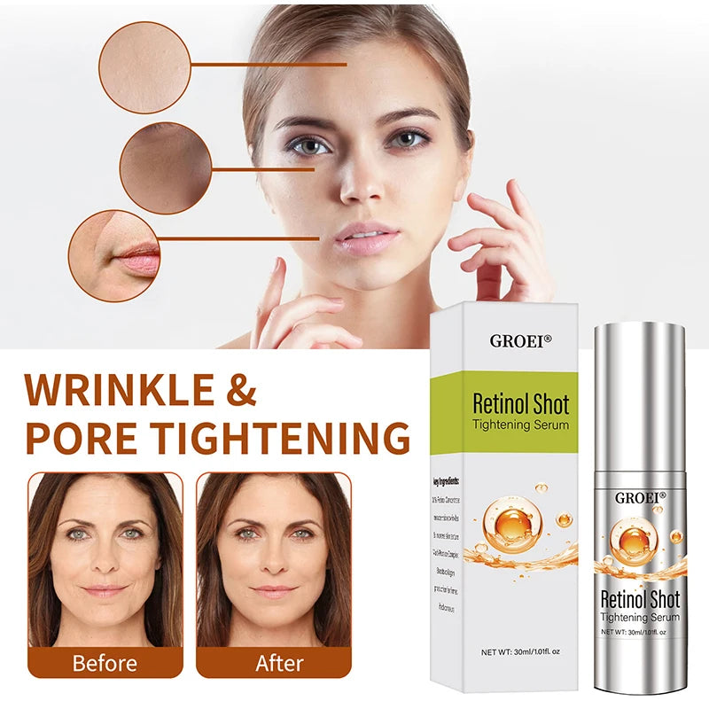 Vita A Retinol Shot Facial Tightening Serum,Eye Tightening Moisturizing Booster Cream,Reduce Wrinkles & Fine Lines,Anti-Aging