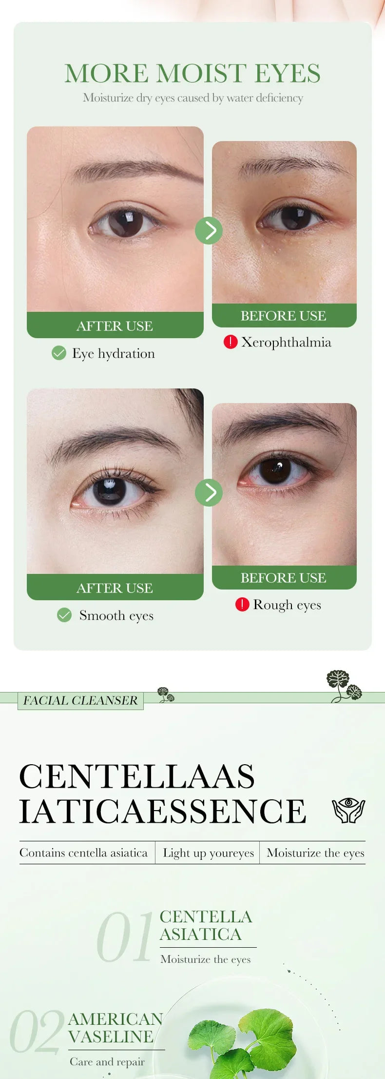 Centella Asiatica Eye Cream Moisturizes Tightens Lightens Dark Circles Eye Cosmetics Smooth Eye Lines Nourishes Makeup