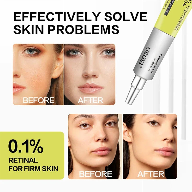 Vita A Retinol Shot Facial Tightening Serum,Eye Tightening Moisturizing Booster Cream,Reduce Wrinkles & Fine Lines,Anti-Aging