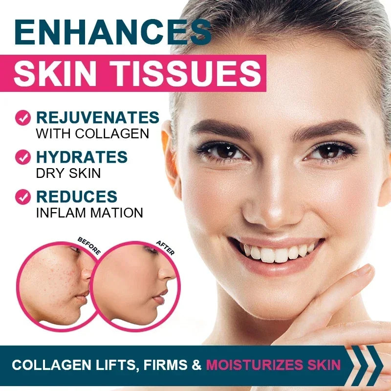 Multiple Collagen - Skin, Joints, Hair, Nail Health, Antioxidant - Collagen Types I, II, III, V, and X