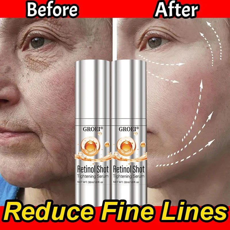 Vita A Retinol Shot Facial Tightening Serum,Eye Tightening Moisturizing Booster Cream,Reduce Wrinkles & Fine Lines,Anti-Aging