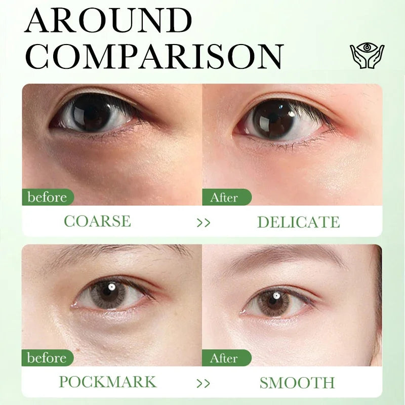 Centella Asiatica Eye Cream Moisturizes Tightens Lightens Dark Circles Eye Cosmetics Smooth Eye Lines Nourishes  Makeup