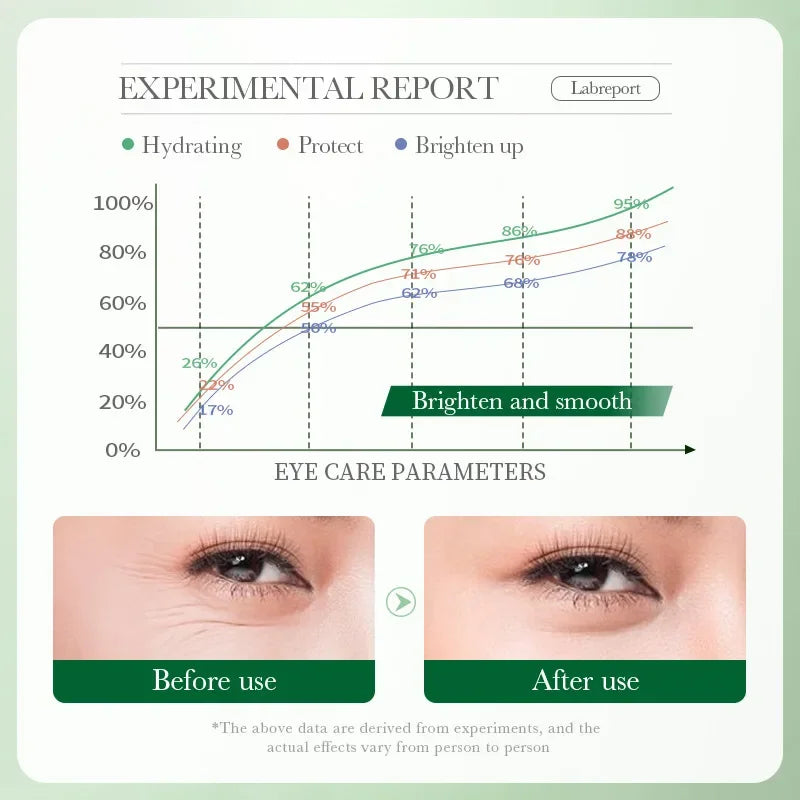 Centella Asiatica Eye Cream Moisturizes Tightens Lightens Dark Circles Eye Cosmetics Smooth Eye Lines Nourishes  Makeup